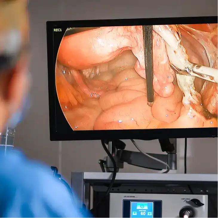 External or superficial GI-related imaging