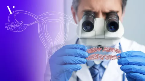 Cervical Cancer in India